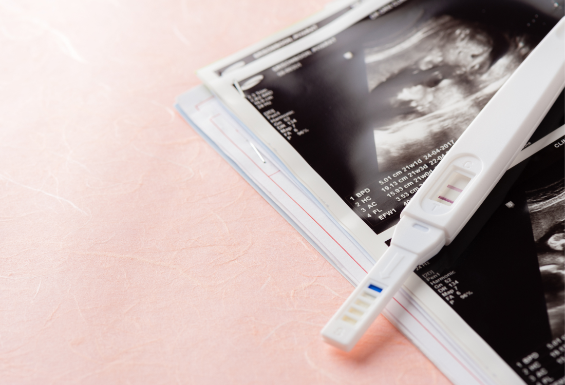 A pregnancy test on top of a scan, showing just how important it is to check the expiry date on a pregnancy test to get the most accurate results possible. 