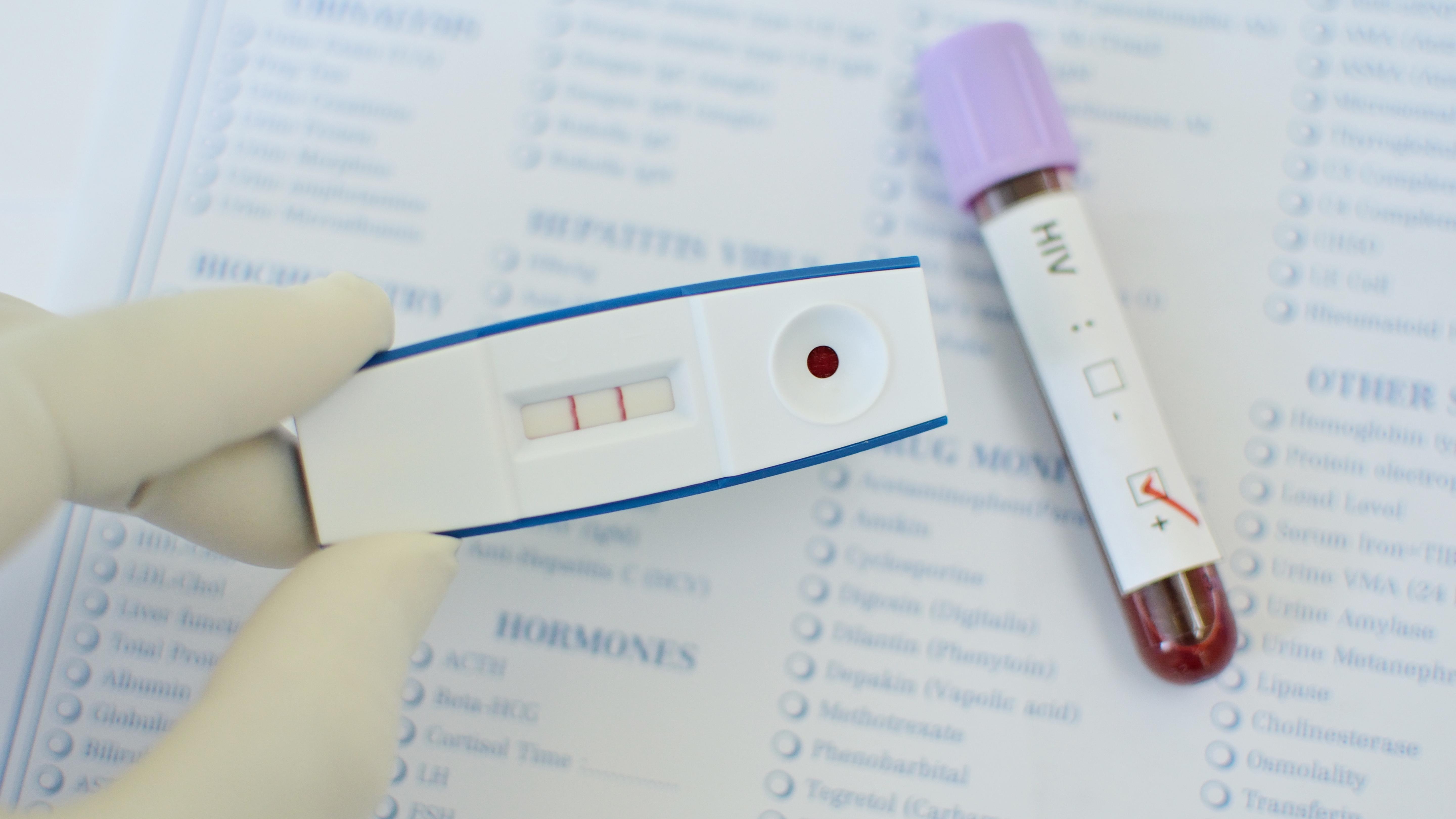 Home testing kits for FSH testing shown alongside a blood sample and medical test results.
